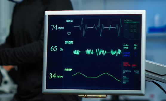 Vitals
monitoring